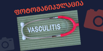 photomanipulatsia 3 Vasculitis or adverse effect of the vaccination?